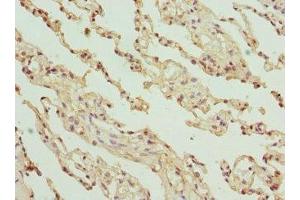 Immunohistochemistry of paraffin-embedded human lung tissue using ABIN7154146 at dilution of 1:100 (GLYCTK 抗体  (AA 284-523))