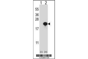 Western blot analysis of CYB5A using rabbit polyclonal CYB5A Antibody using 293 cell lysates (2 ug/lane) either nontransfected (Lane 1) or transiently transfected (Lane 2) with the CYB5A gene. (CYB5A 抗体  (AA 69-98))