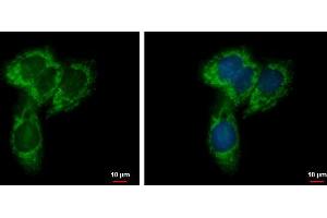 ICC/IF Image NYREN18 antibody [N1N3] detects NYREN18 protein at mitochondria by immunofluorescent analysis.