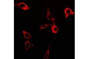 Immunofluorescent analysis of PDC-E2 staining in Hela cells. (DLAT 抗体)