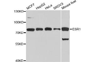 Western blot analysis of extracts of various cell lines, using ESR1 antibody (ABIN5970121) at 1/1000 dilution. (Estrogen Receptor alpha 抗体)