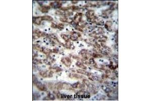 GCDH Antibody (C-term) (ABIN656829 and ABIN2846038) immunohistochemistry analysis in formalin fixed and paraffin embedded human liver tissue followed by peroxidase conjugation of the secondary antibody and DAB staining. (GCDH 抗体  (C-Term))