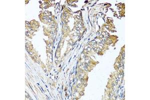 Immunohistochemistry of paraffin-embedded human prostate using STK3 antibody. (STK3 抗体  (AA 323-450))