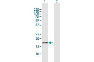 Western Blotting (WB) image for anti-NADH Dehydrogenase (Ubiquinone) 1 beta Subcomplex, 7, 18kDa (NDUFB7) (AA 1-137) antibody (ABIN948174)