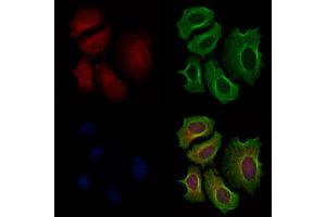 ABIN6261044 and ABIN6279645 staining Hela cells by IF/ICC. (CROT 抗体  (Internal Region))