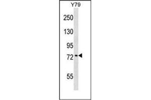 Western Blotting (WB) image for anti-Katanin P80 (WD Repeat Containing) Subunit B 1 (KATNB1) (AA 330-359), (Middle Region) antibody (ABIN952989)