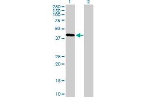 Western Blot analysis of FBXO31 expression in transfected 293T cell line by FBXO31 MaxPab polyclonal antibody. (FBXO31 抗体  (AA 1-367))