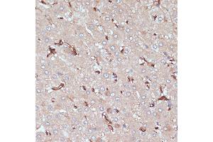 Immunohistochemistry of paraffin-embedded human liver using HLA-DRA antibody (ABIN6131757, ABIN6141827, ABIN6141829 and ABIN6215475) at dilution of 1:100 (40x lens). (HLA-DRA 抗体  (AA 26-216))