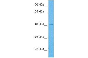 Western Blotting (WB) image for anti-Solute Carrier Family 10 (Sodium/bile Acid Cotransporter Family), Member 1 (SLC10A1) (Middle Region) antibody (ABIN2777141)