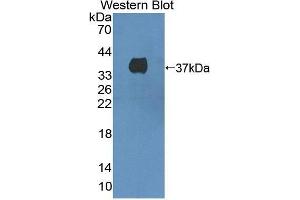Western Blotting (WB) image for anti-Met Proto-Oncogene (MET) (AA 1092-1379) antibody (ABIN1868365) (c-MET 抗体  (AA 1092-1379))