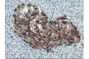 Immunohistochemistry (IHC) image for anti-Plasminogen Activator Inhibitor 1 (SERPINE1) antibody (ABIN1499717) (PAI1 抗体)