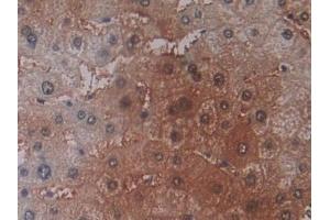 Detection of PEBP1 in Human Liver Tissue using Polyclonal Antibody to Phosphatidylethanolamine Binding Protein 1 (PEBP1) (PEBP1 抗体  (AA 2-187))