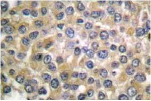 Image no. 1 for anti-Melan A (MLANA) antibody (ABIN265512) (MLANA 抗体)