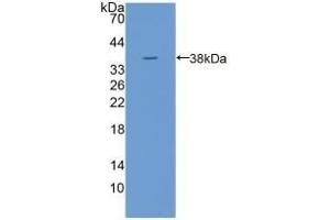 Detection of Recombinant TPP1, Human using Polyclonal Antibody to Tripeptidyl Peptidase I (TPP1) (TPP1 抗体  (AA 1-320))
