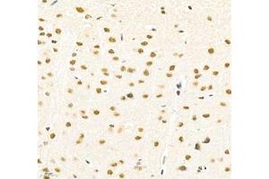 Immunohistochemistry (Paraffin-embedded Sections) (IHC (p)) image for anti-Poly A Binding Protein Nuclear 1 (PABPN1) antibody (ABIN7075116)