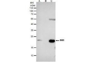 IP Image Bid antibody [N1C3] immunoprecipitates BID protein in IP experiments. (BID 抗体)