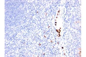Formalin-fixed, paraffin-embedded human Tonsil stained with MYADM Mouse Monoclonal Antibody (MYADM/971). (MYADM 抗体)