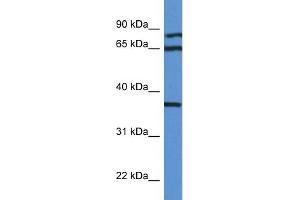 WB Suggested Anti-DHPS AntibodyTitration: 1. (DHPS 抗体  (N-Term))