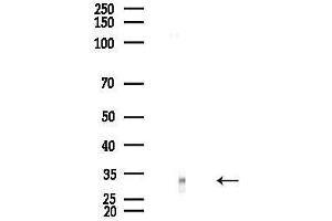 Western blot analysis of lysates from EC304 cells, using SIAH1 Antibody at 1/1000 dilution.