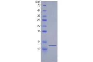 SDS-PAGE analysis of Human HSPA8 Protein. (Hsc70 蛋白)