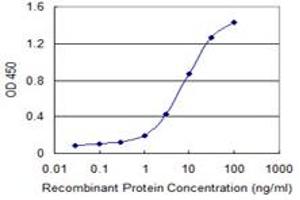 Detection limit for recombinant GST tagged CDC42BPG is 0. (MRCKG 抗体  (AA 1423-1528))
