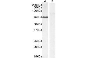 Western Blotting (WB) image for anti-Protein Phosphatase 1, Regulatory (Inhibitor) Subunit 15A (PPP1R15A) (C-Term) antibody (ABIN184571)