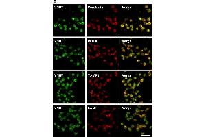 Vesicular nucleotide transporter (VNUT) was present in the dense granules of human platelets. (LAMP1 抗体)