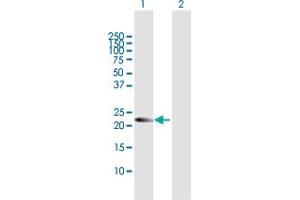 Western Blot analysis of AMN1 expression in transfected 293T cell line by AMN1 MaxPab polyclonal antibody. (AMN1 抗体  (AA 1-213))