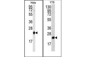 Image no. 1 for anti-Phosphatidylethanolamine Binding Protein 1 (PEBP1) (N-Term) antibody (ABIN360563) (PEBP1 抗体  (N-Term))