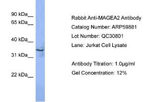 WB Suggested Anti-MAGEA2  Antibody Titration: 0. (MAGEA2 抗体  (N-Term))