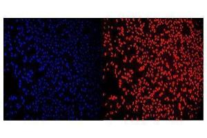 IF analysis of RCC1 using anti-RCC1 antibody (ABIN7600024). (RCC1 抗体  (AA 14-421))
