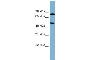WB Suggested Anti-PANK4 Antibody Titration: 0. (PANK4 抗体  (N-Term))