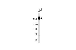 Western blot analysis of lysate from A431 cell line, using MYH14 Antibody at 1:1000. (Myosin 抗体  (AA 654-668))