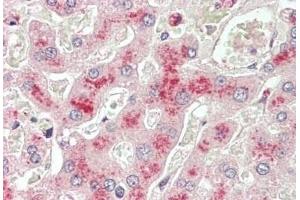 ABIN5539740 (5 μg/mL) staining of paraffin embedded Human Liver. (LCAT 抗体  (AA 366-378))