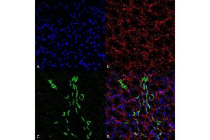 Immunohistochemistry analysis using Rabbit Anti-UT-A1 Polyclonal Antibody (ABIN2486308). (Solute Carrier Family 14 (Urea Transporter, Kidney) Member 2 (SLC14A2) (AA 911-929) 抗体 (APC))