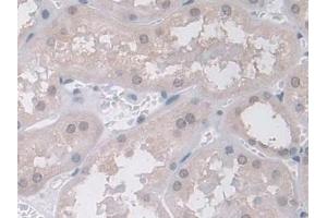 Detection of Ub in Human Kidney Tissue using Polyclonal Antibody to Ubiquitin (Ub) (Ubiquitin 抗体  (AA 1-229))