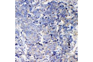 IHC analysis of IQGAP2 using antiIQGAP2 antibody (ABIN5692877). (IQGAP2 抗体  (AA 1329-1544))