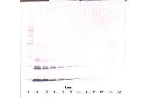 Image no. 2 for anti-Interleukin 3 (IL-3) antibody (ABIN465873) (IL-3 抗体)