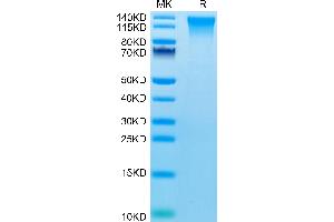 CD248 Protein (AA 18-695) (His tag)