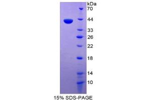 SDS-PAGE (SDS) image for Chemokine (C-C Motif) Ligand 1 (CCL1) (AA 24-96) protein (His tag,GST tag) (ABIN1980897) (CCL1 Protein (AA 24-96) (His tag,GST tag))