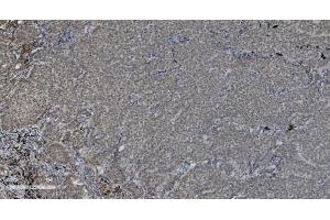 IHC analysis of PARP using anti-PARP antibody (ABIN7602277). (PARP1 抗体  (AA 670-858))