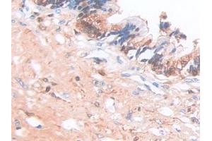 Immunohistochemistry (IHC) image for anti-SR-Related CTD-Associated Factor 11 (SCAF11) (AA 944-1148) antibody (ABIN7443542)