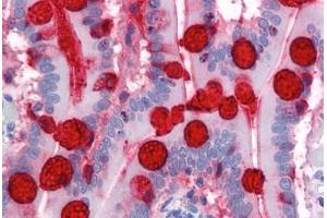 Human Small Intestine: Formalin-Fixed, Paraffin-Embedded (FFPE) (TFF3 抗体  (AA 15-74))