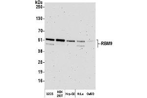 Western Blotting (WB) image for anti-RNA Binding Motif Protein 9 (RBM9) (AA 1-50) antibody (ABIN7454680) (RBM9 抗体  (AA 1-50))