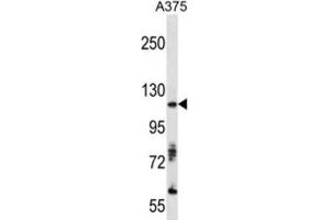 Western Blotting (WB) image for anti-AXL Receptor tyrosine Kinase (AXL) antibody (ABIN3003321) (AXL 抗体)