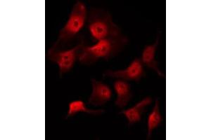 ABIN6269097 staining 293 by IF/ICC. (KRT8 抗体  (C-Term))
