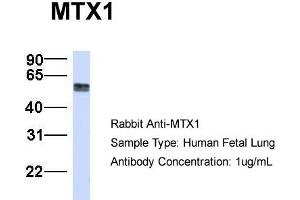 Host:  Rabbit  Target Name:  MTX1  Sample Type:  Human Fetal Lung  Antibody Dilution:  1. (Metaxin 1 抗体  (C-Term))