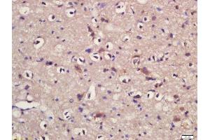 Formalin-fixed and paraffin embedded rat brain labeled with Rabbit Anti-KLC1/KNS2 Polyclonal Antibody, Unconjugated (ABIN1385823) at 1:200 followed by conjugation to the secondary antibody and DAB staining (KLC1 抗体  (AA 1-100))