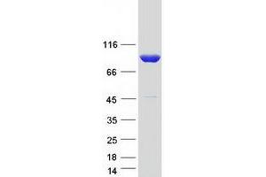 CARS Protein (Transcript Variant 3) (Myc-DYKDDDDK Tag)