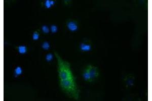 Anti-FSHB mouse monoclonal antibody (ABIN2453055) immunofluorescent staining of COS7 cells transiently transfected by pCMV6-ENTRY FSHB (RC214616). (FSHB 抗体)